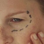 &iquest;Es aconsejable la cirug&iacute;a est&eacute;tica en menores?