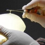 Las clínicas se niegan a dar informes a las víctimas de las PIP