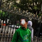 Homenaje a las víctimas que en los enfrentamientos de la semana pasada quedaron ciegos por el impacto de las pelotas de goma que disparaban los agentes