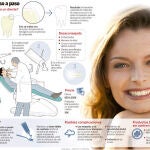 Blanqueamiento dental: los tratamientos sin control pueden provocar la pérdida de piezas