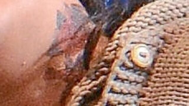 Netrebko luce un tatuaje en su cuello (su pareja, Erwin Schrott, también es aficionado). ¿Motivo? La red se hace eco de las teorías más variopintas