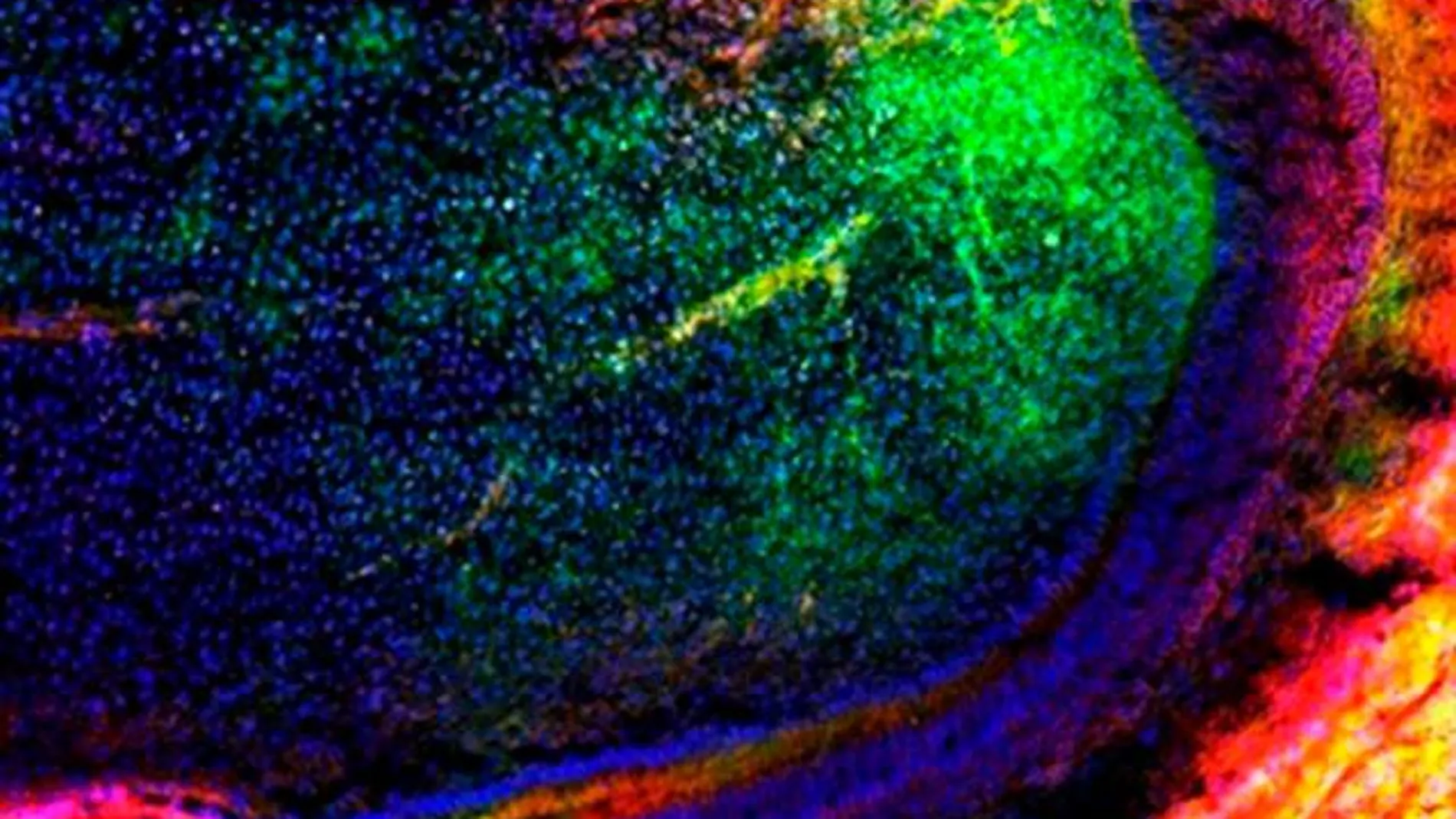 La imagen muestra a un grupo de células madre mesenquimales (verde) migrando en un diente para regenerar a un más los tejidos