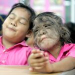 Imagen de archivo de una niña con hipertricosis
