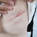 Imagen de la agresión realizada por una presa de Murcia a un funcionario de prisiones