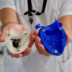 El paciente muestra una réplica de su corazón que ha servido al equipo médico para poder intervenirlo