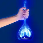 Cada año se registran 30.000 casos nuevos de cáncer de pulmón microcítico en Estados Unidos