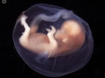 La embriodonación consiste en descongelar embriones que proceden de otras parejas que los han donado con fines reproductivos. Posteriormente, se transfieren al útero de la mujer receptora. La embriodonación consiste en descongelar embriones que proceden de otras parejas que los han donado con fines reproductivos. Posteriormente, se transfieren al útero de la mujer receptora.