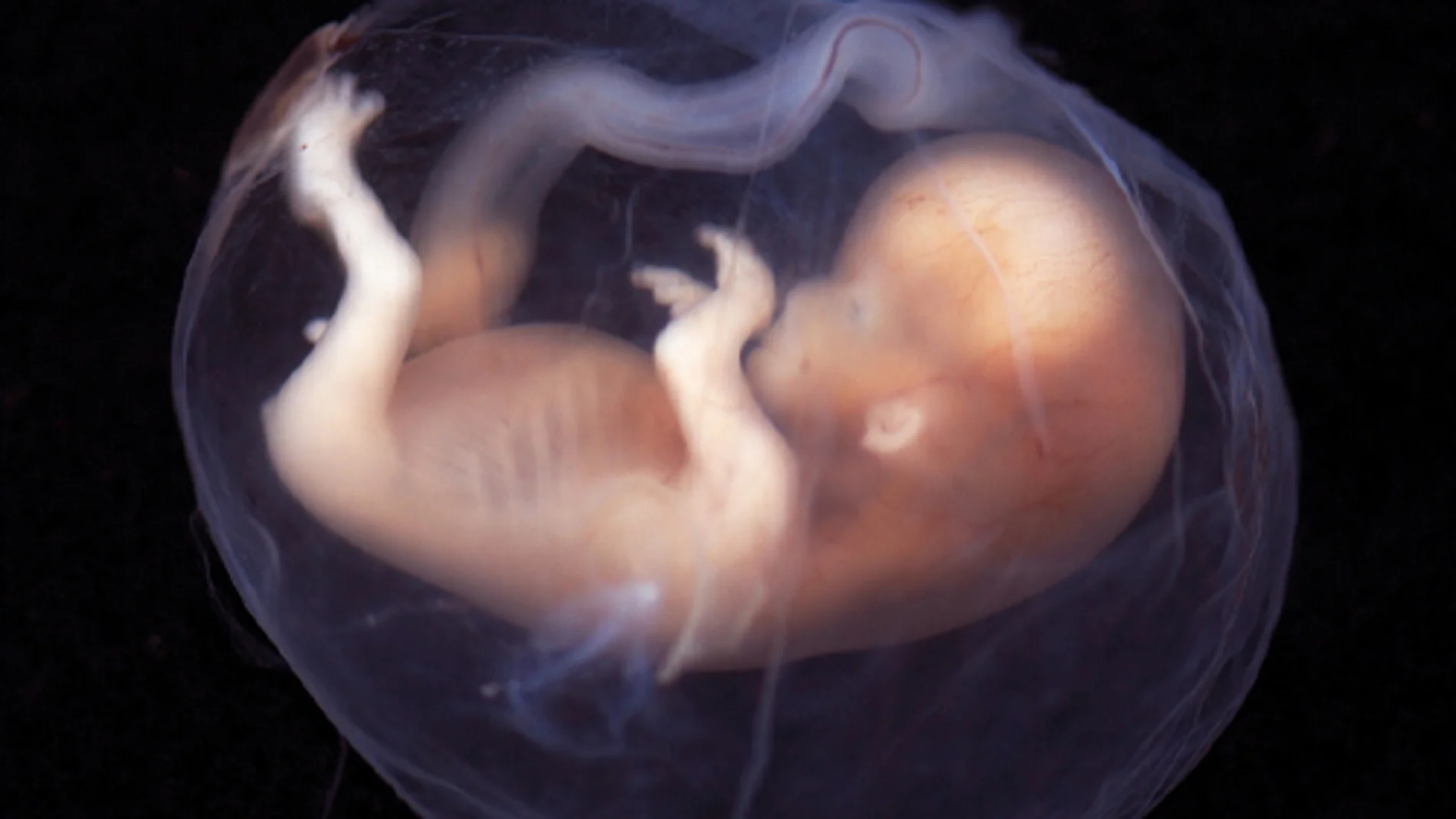 La embriodonación consiste en descongelar embriones que proceden de otras parejas que los han donado con fines reproductivos. Posteriormente, se transfieren al útero de la mujer receptora.