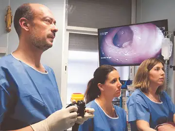 En la imagen, profesionales de la salud realizan una colonoscopia En la imagen, profesionales de la salud realizan una colonoscopia
