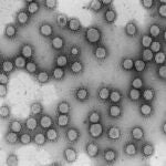 España invierte casi 1.800 millones de euros y emplea a más de 27.000 personas en investigación de biotecnologíaCSIC22/03/2020