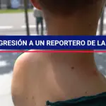 Agresión a un informador gráfico de La Razón