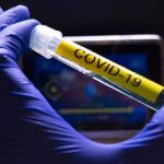 Prueba de Covid-19