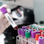 Estudio sobre los pacientes COVID-19 atendidos en los centros de salud de la Comunidad de Madrid