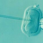 Según el doctor Jan Tesarik, Director de la Clínica MARGen "las pandemias vienen y se van y no tendrían que condicionar la calidad de vida de las mujeres que desean ser madres y necesitan una ayuda médica antes de que sea demasiado tarde".