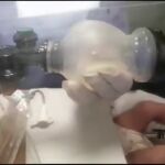 Ventilación manual a un bebé en Perú