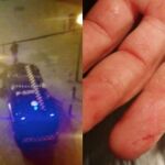 El agente publicó la imagen de su mano en las redes sociales