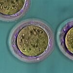[Comunicacionumu] Investigadores De La Umu Y El Imib Descubren Una Proteína Del Espermatozoide Esencial Para Que Ocurra La FecundaciónUNIVERSIDAD DE MURCIA08/07/2020
