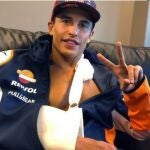 Marc Márquez sufre la fractura completa del tercio medio del húmero del brazo derecho con leve desplazamiento