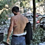 Un vecino de Beirut muestra sus heridas en la espalda provocadas por la explosión