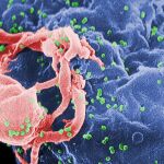 Imágenes de un microoscopio electrónico de la médula ósea infectada por VIH