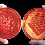 Propuestas para vencer la resistencia bacteriana a los antimicrobianos