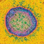 Imagen de un virus de la hepatitis C tomado bajo un microscopio electrónico y con el color editado. (Autoría de Cavallini James)