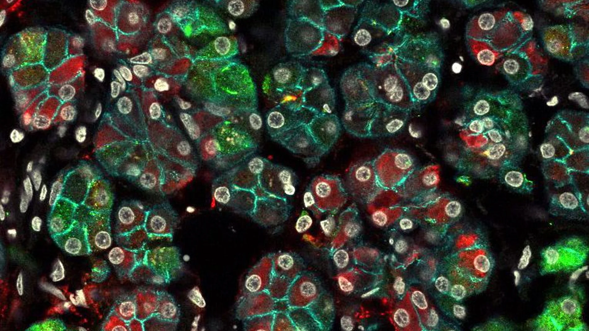 Imagen microscópica de inmunofluorescencia de células en una glándula submaxilar humana. La imagen revela que las células acinares secretoras, que se pensaba que eran iguales, en realidad son más diversas, como lo muestran las diferentes células de la misma glándula que expresan diferentes proteínas. Una mancha verde indica la presencia de mucina 7 ( proteína que da a la saliva la consistencia babosa) y una mancha roja indica la presencia de amilasa. Los núcleos de células están en gris y la membrana epitelial en turquesa