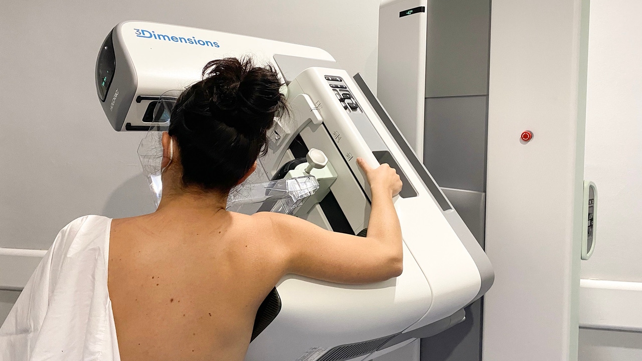 Cádiz, Sevilla y Málaga son las provincias con más casos por revisar del cribado de cáncer de mama