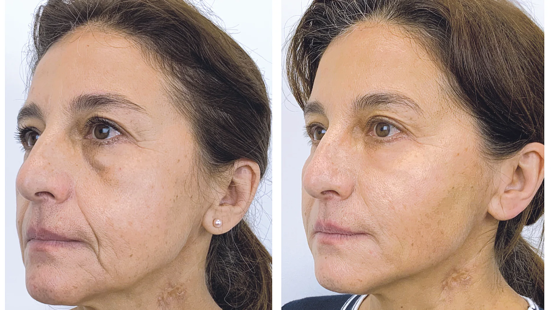 “El positive face es buscar la mejor versión del rostro de cada persona, sin seguir un patrón impuesto por la moda o los cánones de belleza”