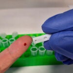 Un nuevo test permite detectar anticuerpos de covid-19 empleando células cultivadas.