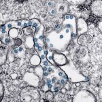 Partículas del virus SARS-CoV-2, coloreadas en azul, en una imagen de microscopio de electrones.