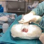 Las extracciones renales y los trasplantes se realizaron el mismo día en el Hospital Regional Universitario de Málaga y la Fondazione Policlinico Universitario Agostino Gemelli IRCSS de Roma