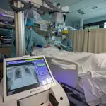 UCI del Hospital Clínico de Santiago