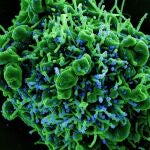 “Khosta-2″: encuentran en murciélagos rusos un virus similar a la Covid que puede infectar a los humanos y esquivar las vacunas