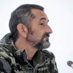 El cirujano Pedro Cavadas ha presentado los detalles de la intervención de todos los cánceres múltiples de piel que ha logrado llevar a cabo en un paciente albino procedente de Guinea Ecuatorial, especialmente uno extenso de la cara con reconstrucción microquirúrgica compleja.EFE/ Biel Aliño