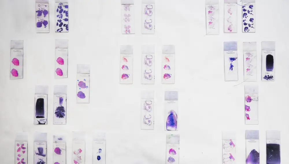 Analiza, una década ayudando con el diagnóstico a médicos y pacientes