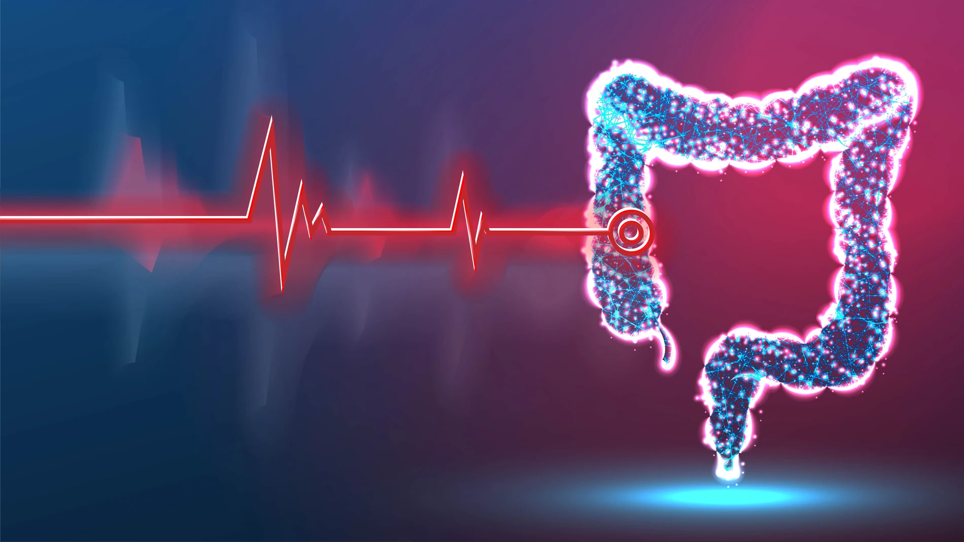 Cáncer de colon