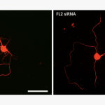 Las neuronas tratadas con el fármaco regeneran sus axones a un ritmo significativamente más rápido que las neuronas tratadas con control
