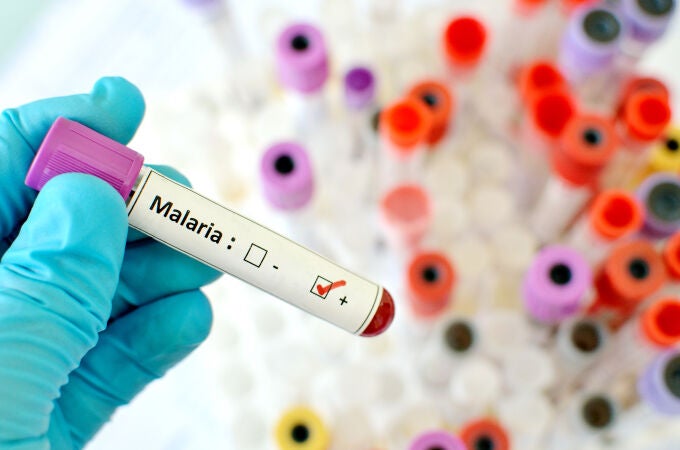 Infectada de malaria en el Hospital Virgen del Rocío de Sevilla