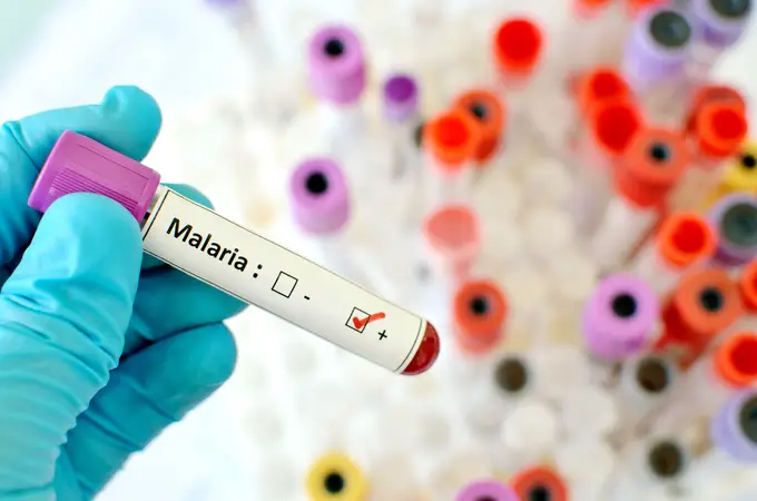 Infectada de malaria en el Hospital Virgen del Rocío de Sevilla Infectada de malaria en el Hospital Virgen del Rocío de Sevilla