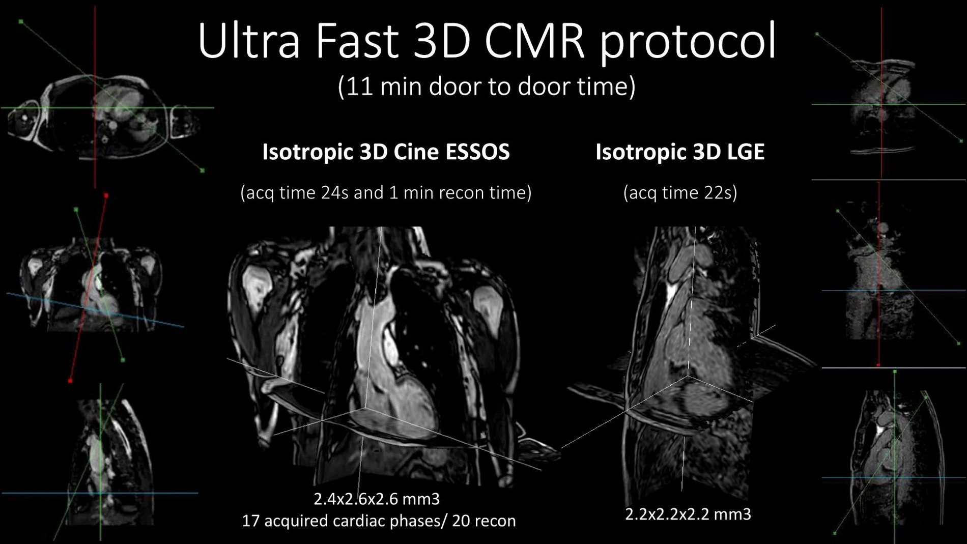 Visualización en tres dimensiones de los estudios de anatomía, función y caracterización del corazón que se han obtenido con la nueva tecnología.