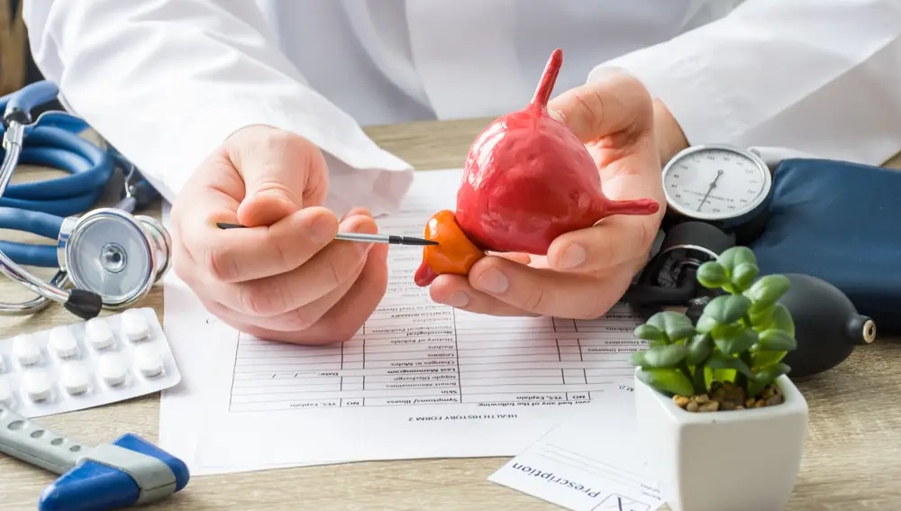 Los alimentos que se vinculan con el de cáncer de próstata agresivo