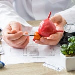 Los alimentos que se vinculan con el de cáncer de próstata agresivo