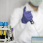 Análisis para cribado de Hepatitis