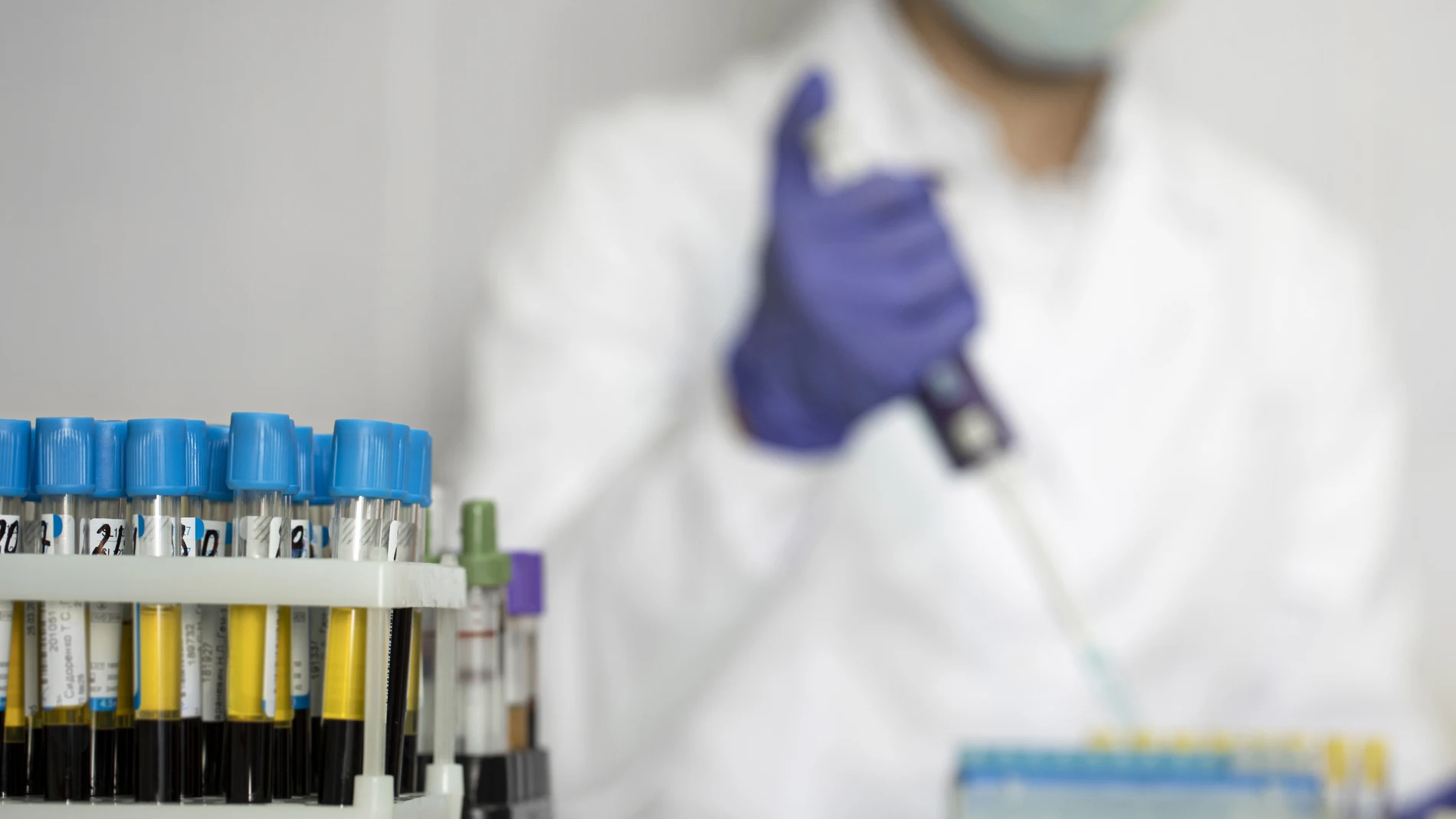 Análisis para cribado de Hepatitis