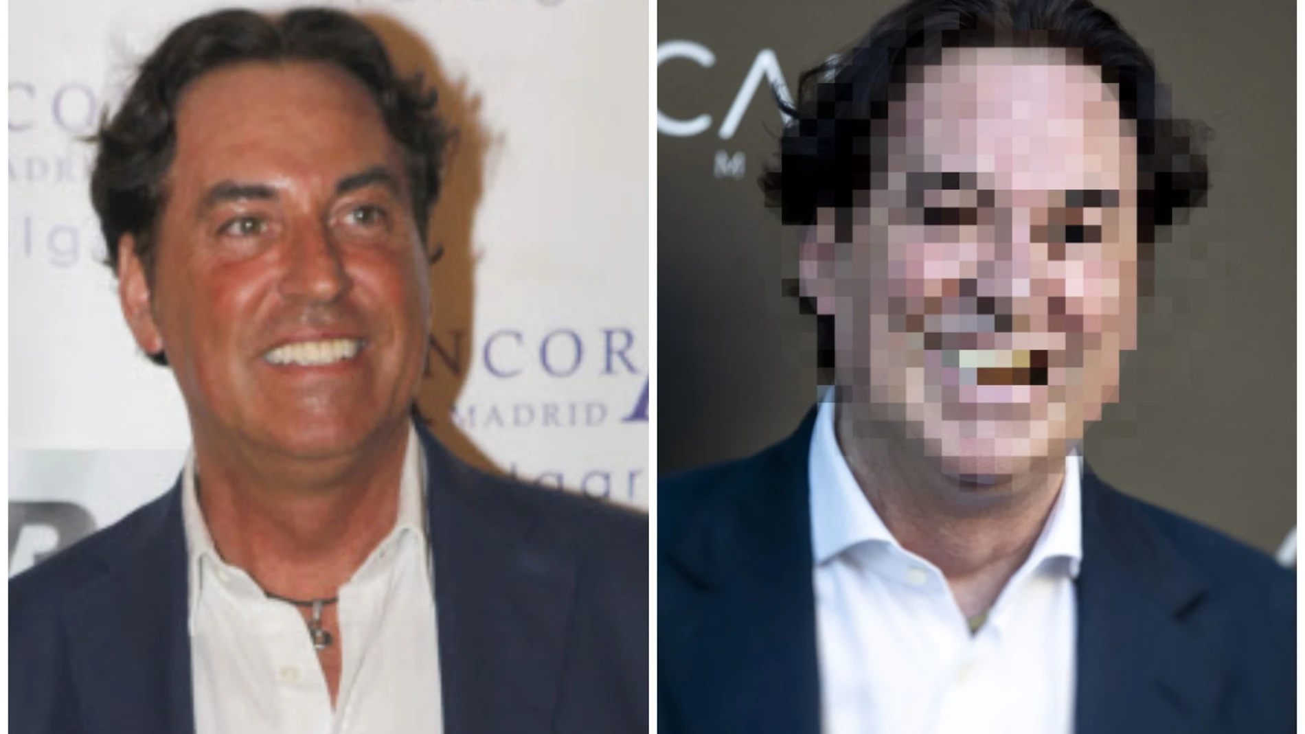 El antes y después de Pipi Estrada en un montaje de La Razón