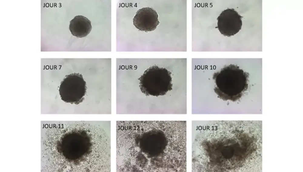 Tumores que se desintegran gracias a la acción de un conocido Omega-3