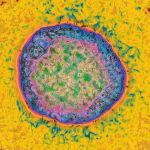 Virus Hepatitis C