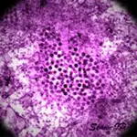 Virus del Nilo Occidental