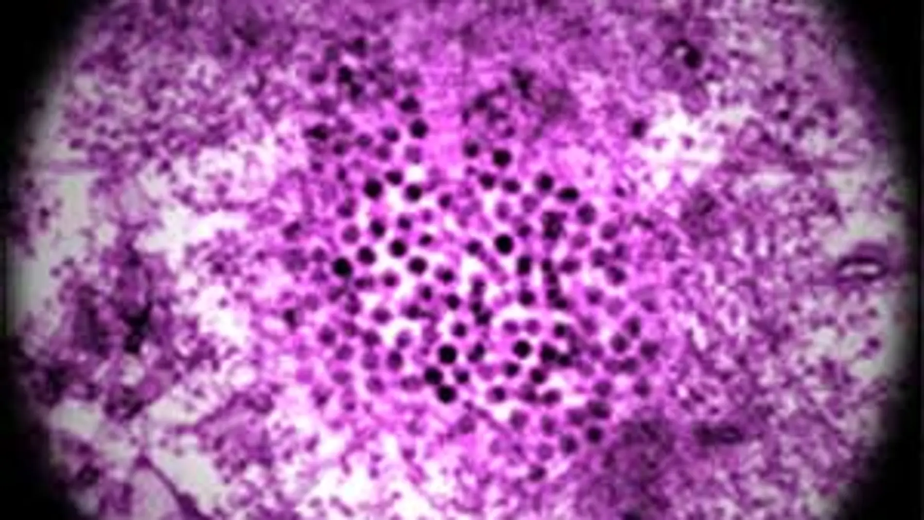 Virus del Nilo Occidental